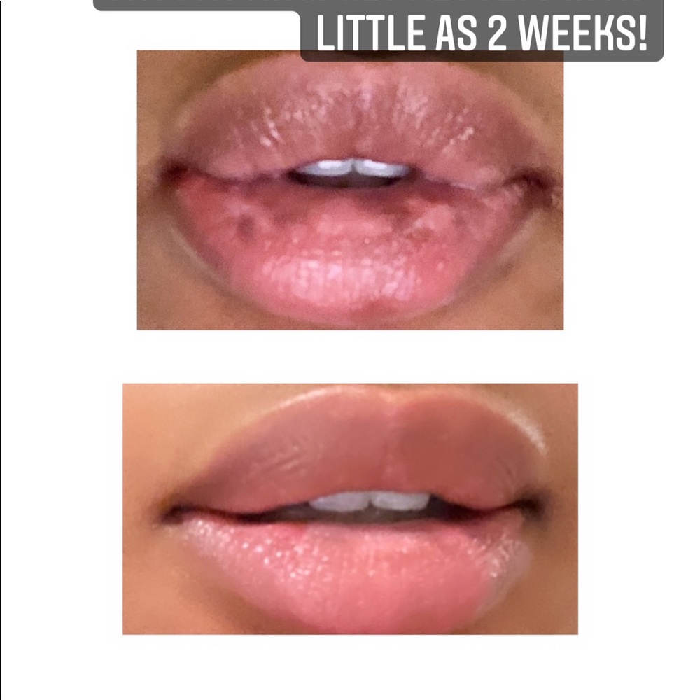 All natural, lip balm created to lighten lips - Picture 4 of 5